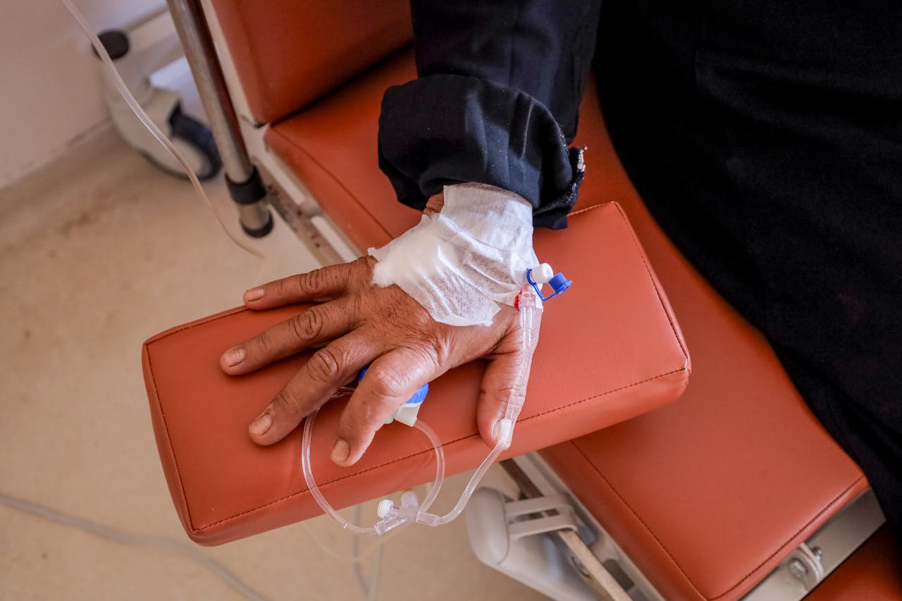 Close-up of a patient's hand receiving chemotherapy treatment in a medical facility.