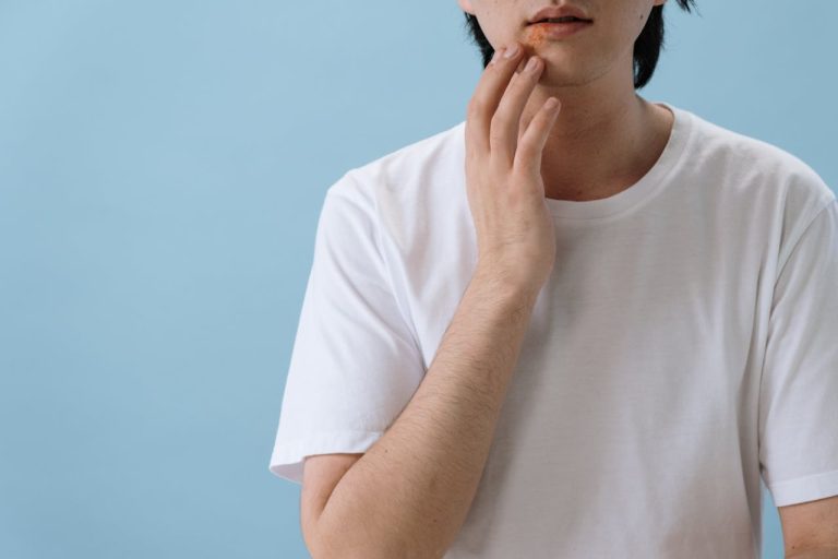 Close-up of a man touching his face showing signs of a skin condition or allergy.