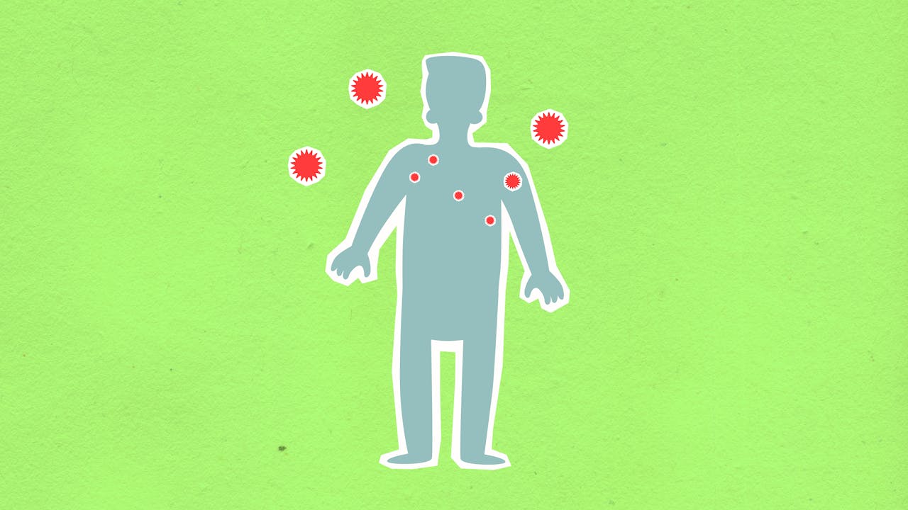 Paper cutout of male silhouette surrounded with many spreading contagious red viruses on green background during dangerous coronavirus disease outbreak